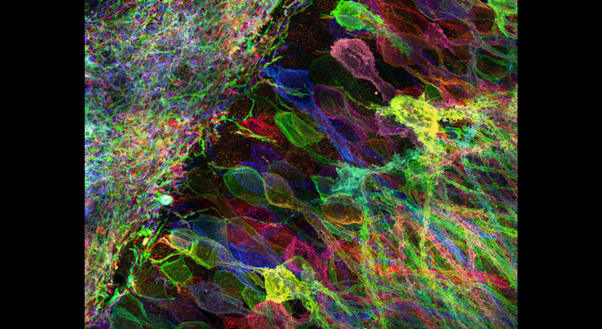 Mouse hippocampal neurons viewed with Expansion Microscopy